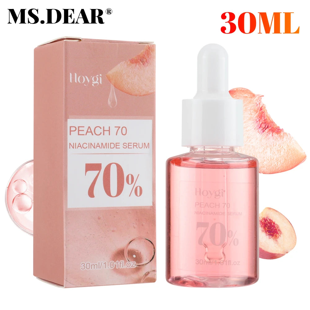 30ml Niacinamide Serum Melanin Removal Fade Melasma Dark Spots Corrector Shrink Pores Hyaluronic Acid Moisturizing Skin Care